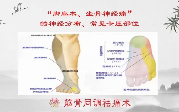 赵鹏飞 “脚麻、坐骨神经痛”的神经分布、卡压部位与调理手法 全3讲视频课